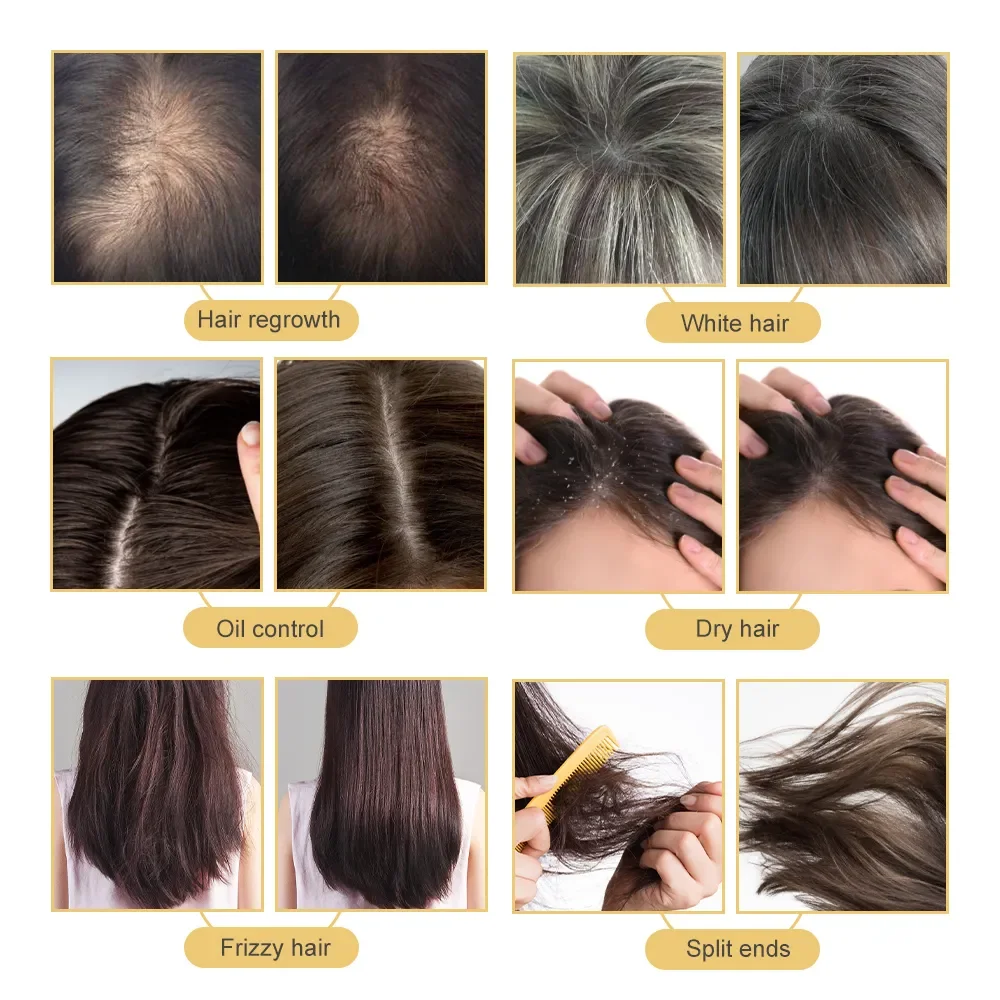 Healthy Hair Essentials: Scalp Care & Growth Solution